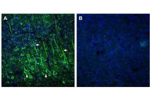 Expression of EphA2 in mouse cortex. (EPH Receptor A2 anticorps  (Extracellular, N-Term))