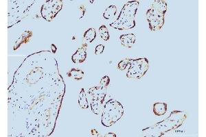 IHC analysis of Cyclophilin E/PPIE using anti-Cyclophilin E/PPIE antibody (ABIN7599243). (PPIE anticorps  (AA 1-301))