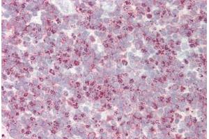 Human Tonsil: Formalin-Fixed, Paraffin-Embedded (FFPE)