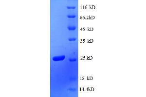 SDS-PAGE (SDS) image for RS4, Ribosomal Protein 4 (RS4) (AA 2-206) protein (His tag) (ABIN5712592) (RS4 Protein (AA 2-206) (His tag))