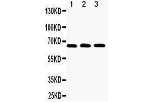 Anti-RANK antibody, Western blotting Lane 1: Recombinant Human RANK Protein 10ng Lane 2: Recombinant Human RANK Protein 5ng Lane 3: Recombinant Human RANK Protein 2.