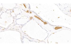 Detection of GYPA in Human Thyroid Tissue using Polyclonal Antibody to Glycophorin A (GYPA) (CD235a/GYPA anticorps  (AA 20-91))