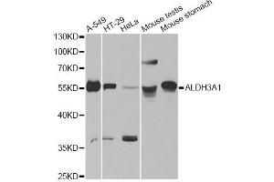Western blot analysis of extracts of various cell lines, using ALDH3A1 antibody. (ALDH3A1 anticorps)