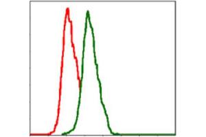 Immunohistochemical analysis of paraffin-embedded cervical cancer tissues using ITGB1 antibody with DAB staining. (ITGB1 anticorps)
