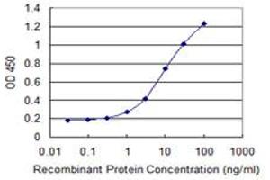 Detection limit for recombinant GST tagged EXOSC4 is 0.