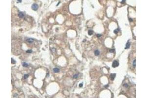 Immunohistochemical analysis of paraffin-embedded human fetal liver showing cytoplasmic staining with HINT2 polyclonal antibody  at a 1 : 100 dilution. (HINT2 anticorps  (AA 59-163))