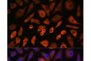 anti-Neural Wiskott-Aldrich syndrome protein (WASL) antibody