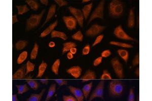 Immunofluorescence analysis of L-929 cells using N-WASP Polyclonal Antibody at dilution of 1:100 (40x lens). (Neural Wiskott-Aldrich syndrome protein (WASL) anticorps)