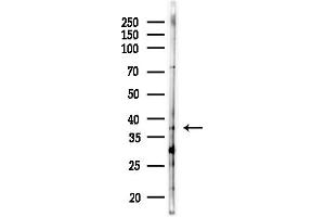 anti-Peroxisomal Biogenesis Factor 7 (PEX7) (C-Term) antibody