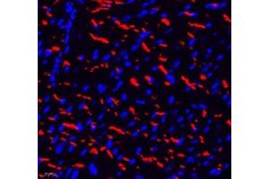 Immunofluorescence of paraffin embedded rat heart using THNSL2 (ABIN7075893) at dilution of 1: 400 (400x lens)
