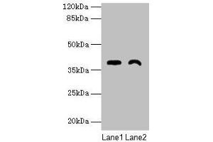 Western blot All lanes: TMEM255A antibody at 6 μg/mL Lane 1: Mouse stomach tissue Lane 2: Mouse heart tissue Secondary Goat polyclonal to rabbit IgG at 1/10000 dilution Predicted band size: 39, 21, 36, 27 kDa Observed band size: 39 kDa (FAM70A anticorps  (AA 110-225))