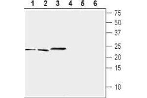 Western blot analysis of mouse brain (lanes 1 and 4), rat brain (lanes 2 and 5) and rat eye (lanes 3 and 6) lysates (1:200-1:400): - 1-3. (NCS1 anticorps  (Intracellular))