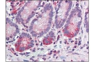 Immunohistochemistry (IHC) image for anti-Tyrosyl-DNA Phosphodiesterase 1 (TDP1) (AA 1-298), (N-Term) antibody (ABIN400858) (TDP1 anticorps  (N-Term))