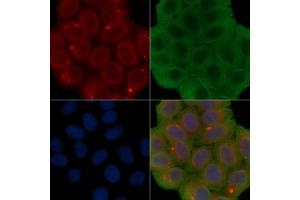 ABIN6260877 and ABIN6277178 staining Hela cells(30 min of UV treatment) by IF/ICC.