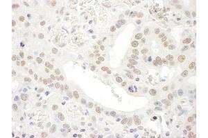 Immunohistochemistry (IHC) image for anti-Transcription Elongation Factor A (SII), 3 (TCEA3) (AA 200-250) antibody (ABIN7454550)