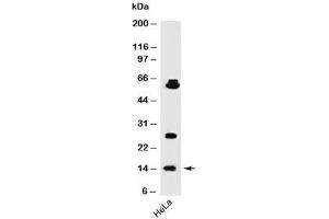 Western blot testing of human samples using SUMO1 antibody (SM1/495). (SUMO1 anticorps)