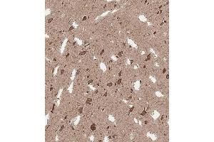 Immunohistochemical analysis of A on paraffin-embedded Human brain tissue. (QKI anticorps  (N-Term))