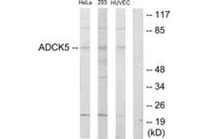 Western Blotting (WB) image for anti-AarF Domain Containing Kinase 5 (ADCK5) (AA 151-200) antibody (ABIN2889630) (ADCK5 anticorps  (AA 151-200))