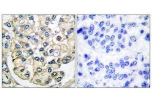 Immunohistochemistry (IHC) image for anti-Fibroblast Growth Factor Receptor 2 (FGFR2) (Internal Region) antibody (ABIN1848540) (FGFR2 anticorps  (Internal Region))