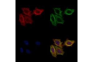ABIN6261692 and ABIN6277568 staining HepG2 cells by IF/ICC. (FBP1 anticorps  (Internal Region))