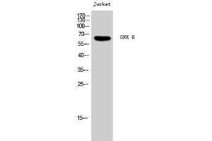 Western Blotting (WB) image for anti-G Protein-Coupled Receptor Kinase 6 (GRK6) (N-Term) antibody (ABIN3184947)