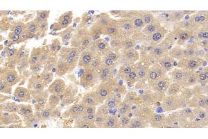 Detection of MCSFR in Mouse Liver Tissue using Polyclonal Antibody to Colony Stimulating Factor Receptor, Macrophage (MCSFR) (CSF1R anticorps  (AA 639-868))