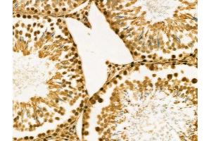 ABIN6257254 and ABIN6274135 at 1/100 staining Rat testis tissue by IHC-P. (MYST2 anticorps  (Internal Region))