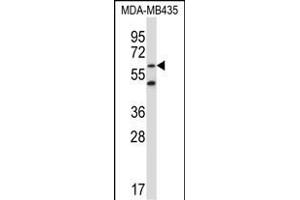 ZN Antibody (N-term) (ABIN657803 and ABIN2846776) western blot analysis in MDA-M cell line lysates (35 μg/lane). (ZNF479 anticorps  (N-Term))