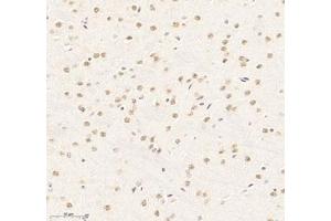 Immunohistochemistry of paraffin embedded mouse brain using RBM8A (ABIN7075478) at dilution of 1: 300 (300x lens) (RBM8A anticorps)