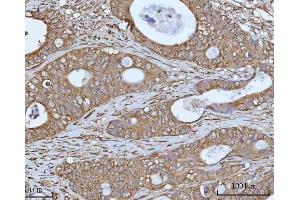 IHC analysis of OCRL using anti-OCRL antibody (ABIN7599572). (OCRL anticorps  (AA 1-901))