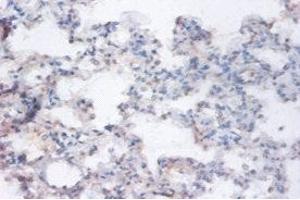 Immunohistochemistry of paraffin-embedded human lung tissue using ABIN7167205 at dilution of 1:100 (RRAGA anticorps  (AA 1-247))