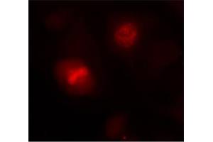 Image no. 1 for anti-Histone H3.1 (HIST1H3B) (Ser10) antibody (ABIN197332) (Histone H3.1 anticorps  (Ser10))