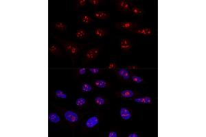 Confocal immunofluorescence analysis of U2OS cells using NOP58 Polyclonal Antibody  at dilution of 1:100. (NOP58 anticorps  (AA 360-529))