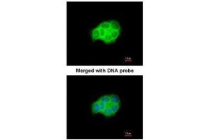 ICC/IF Image Immunofluorescence analysis of paraformaldehyde-fixed A431, using HSPA6, antibody at 1:200 dilution.