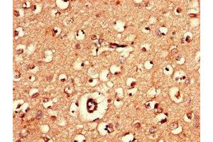 Immunohistochemistry of paraffin-embedded human brain tissue using ABIN7143348 at dilution of 1:100 (Adenylate Kinase 5 anticorps  (AA 61-215))
