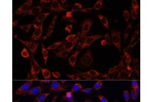 Immunofluorescence analysis of NIH/3T3 cells using UCP3 Polyclonal Antibody at dilution of 1:100. (UCP3 anticorps)