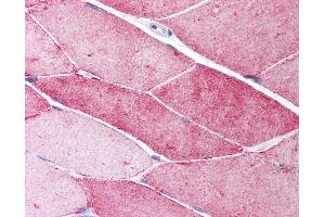 Anti-CAV3 / Caveolin 3 antibody IHC of human skeletal muscle.