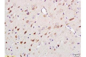 Formalin-fixed and paraffin embedded rat brain tissue labeled Anti-NF-H/Neurofilament H/Neurofilament 200 Polyclonal Antibody , Unconjugated at 1:200, followed by conjugation to the secondary antibody and DAB staining
