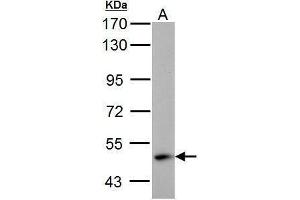 WB Image ABAT antibody detects ABAT protein by Western blot analysis.