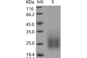 Western Blotting (WB) image for Tetraspanin 7 (TSPAN7) protein (His tag) (ABIN7320122)