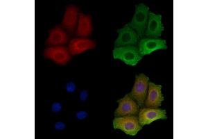ABIN6259283 and ABIN6275619 staining Hela cells by IF/ICC.