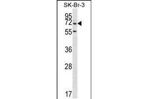 Western blot analysis in SK-BR-3 cell line lysates (35ug/lane). (ZNF398 anticorps  (AA 186-215))