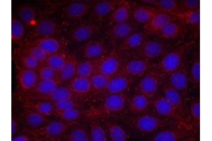 Immunofluorescence staining of methanol-fixed MCF cells using VEGFR2(Phospho-Tyr1214) Antibody. (VEGFR2/CD309 anticorps  (pTyr1214))