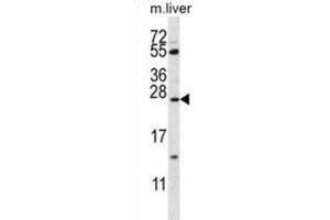 Western Blotting (WB) image for anti-Surfactant Protein C (SFTPC) antibody (ABIN2911136) (Surfactant Protein C anticorps)