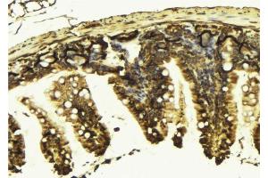 ABIN6277591 at 1/100 staining Mouse colon tissue by IHC-P. (KIF2C anticorps  (C-Term))