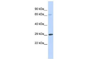 FCER1A antibody used at 1 ug/ml to detect target protein. (Fc epsilon RI/FCER1A anticorps  (Middle Region))