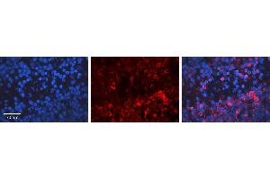 Rabbit Anti-E2F1 Antibody Catalog Number: ARP31171_P050 Formalin Fixed Paraffin Embedded Tissue: Human Lymph Node Tissue Observed Staining: Cytoplasm Primary Antibody Concentration: 1:100 Other Working Concentrations: 1:600 Secondary Antibody: Donkey anti-Rabbit-Cy3 Secondary Antibody Concentration: 1:200 Magnification: 20X Exposure Time: 0. (E2F1 anticorps  (Middle Region))