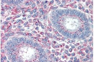 Human Uterus (formalin-fixed, paraffin-embedded) stained with PRRX1 antibody ABIN337108 at 5 ug/ml followed by biotinylated anti-goat IgG secondary antibody ABIN481715, alkaline phosphatase-streptavidin and chromogen. (PRRX1 anticorps  (AA 73-83))