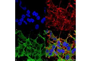 Immunocytochemistry/Immunofluorescence analysis using Mouse Anti-SUR2A Monoclonal Antibody, Clone S319A-14 . (ABCC9 anticorps  (AA 1505-1546))