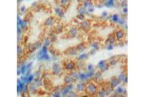Used in DAB staining on fromalin fixed paraffin-embedded Kidney tissue